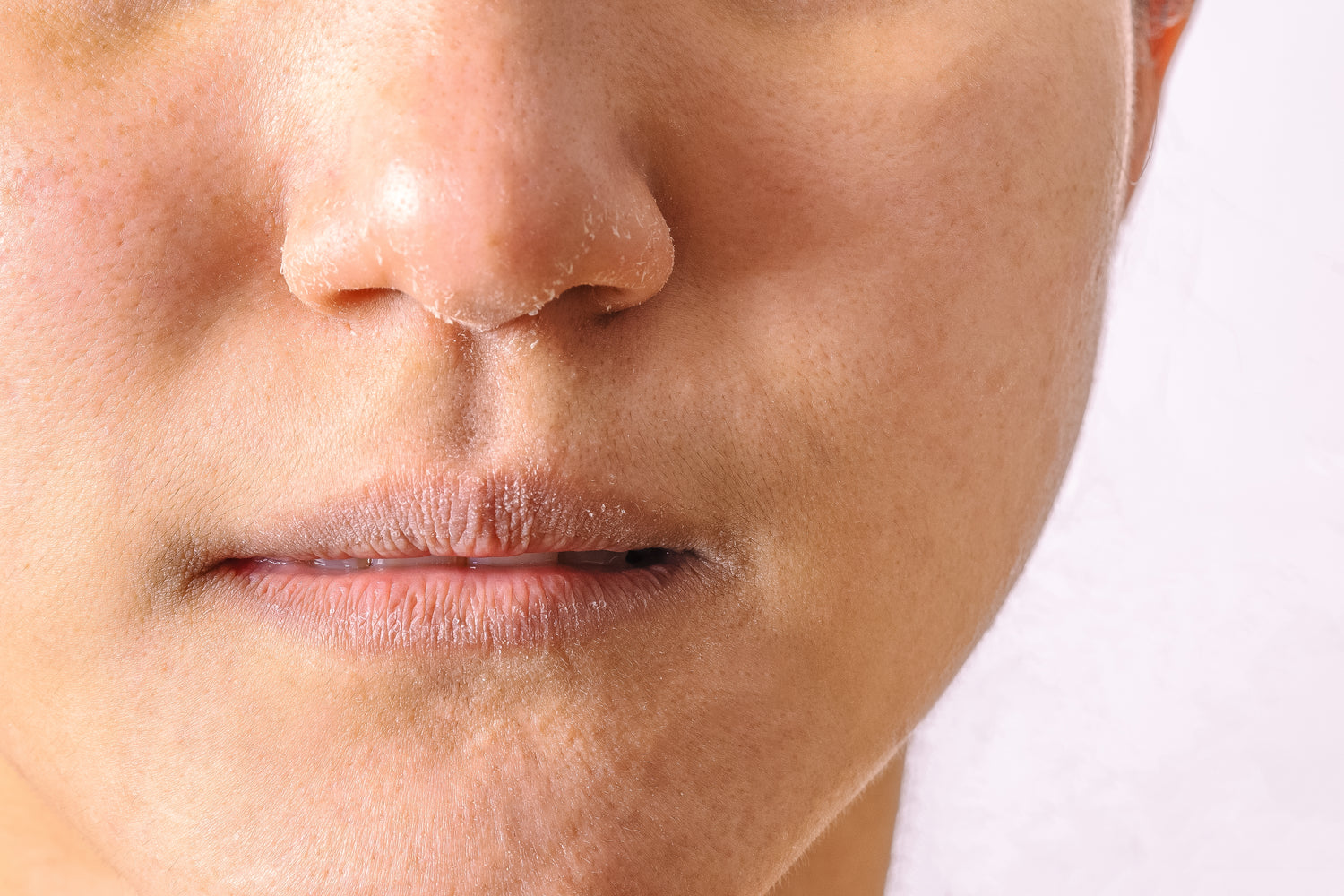 6 simple lifestyle changes to tackle genetic dry skin