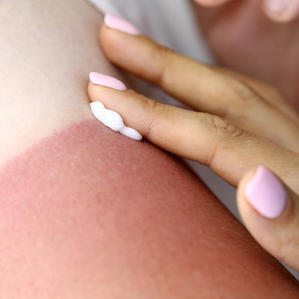 6 Mistakes to Avoid If You Have Dry Skin