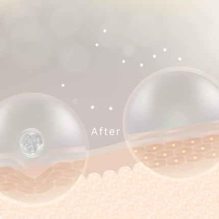 4 reasons you should be using Hyaluronic Acid for dry skin