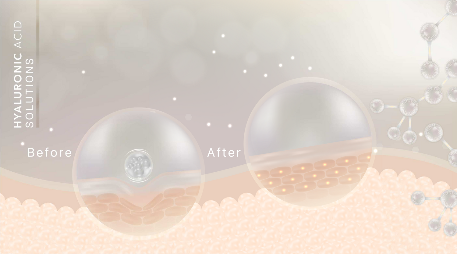 4 reasons you should be using Hyaluronic Acid for dry skin