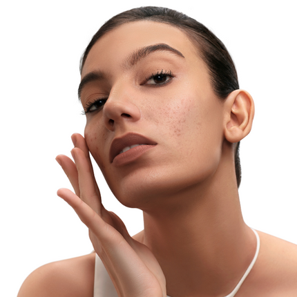 Beyond the Surface: The Real Reasons Behind Hyperpigmentation