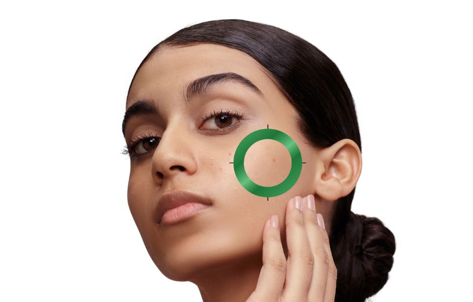 Is Salicylic Acid Secretly Sabotaging Your Skin's Microbiome?
