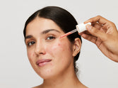 A Complete Solution to Getting Rid of Hyperpigmentation#New Technology that Works on Root Causes of Hyperpigmentation
