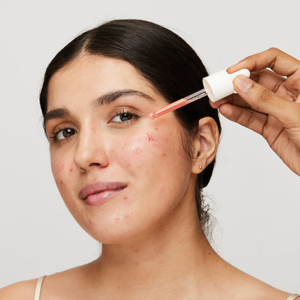 A Complete Solution to Getting Rid of Hyperpigmentation#New Technology that Works on Root Causes of Hyperpigmentation