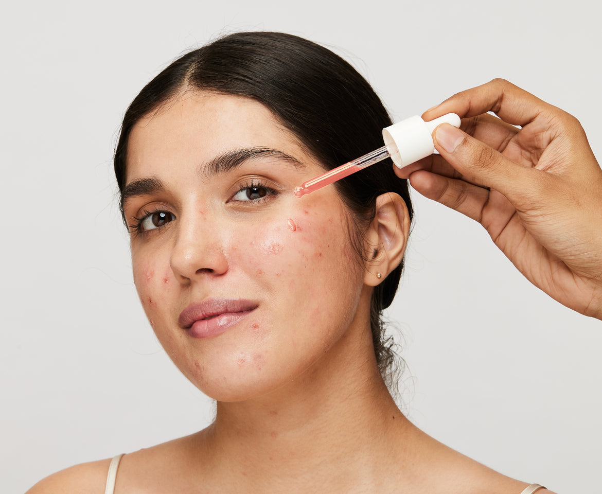 Expert-backed Combo Solution for Hyperpigmentation