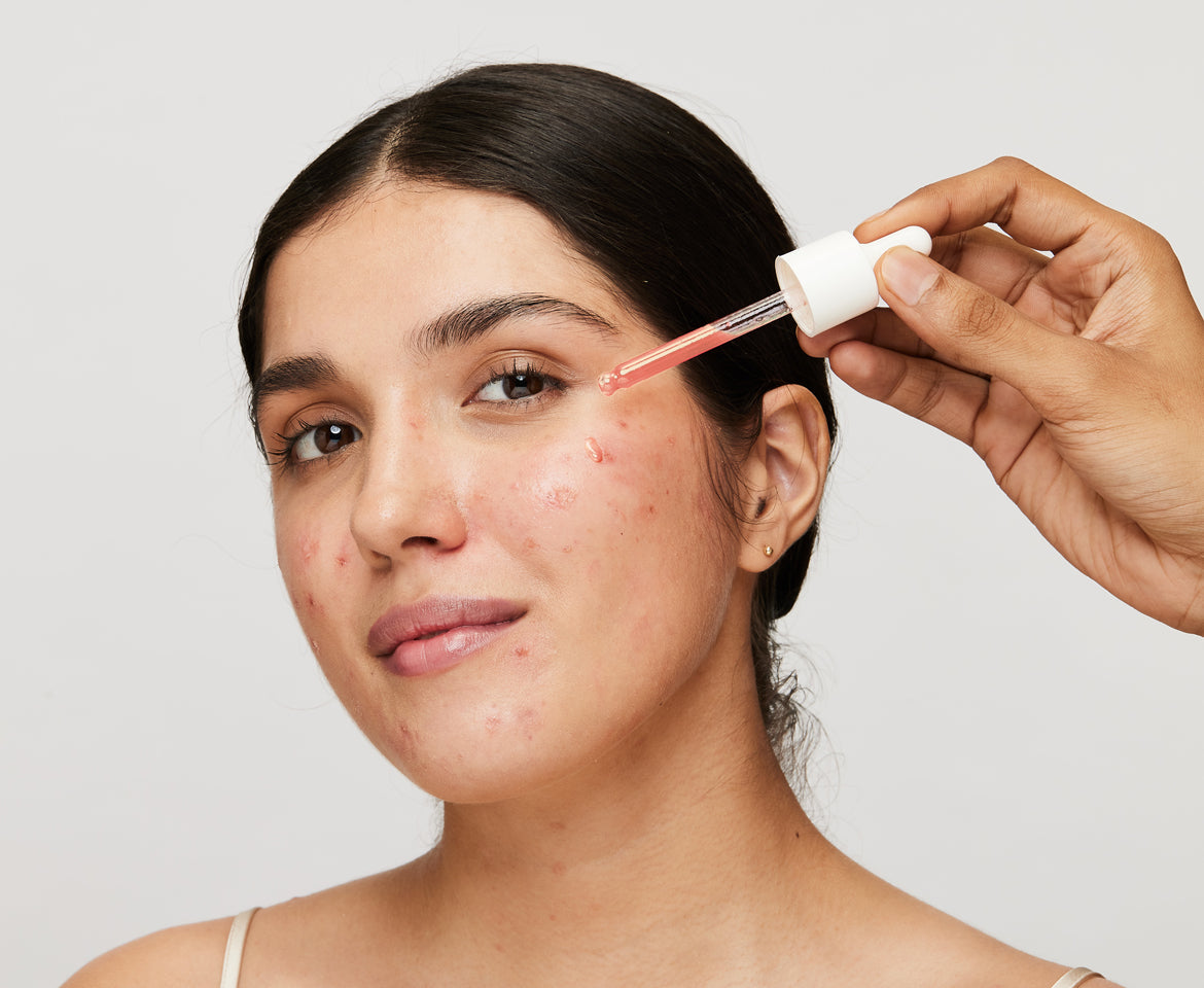 Triple-action Solution to combat  Hyperpigmentation