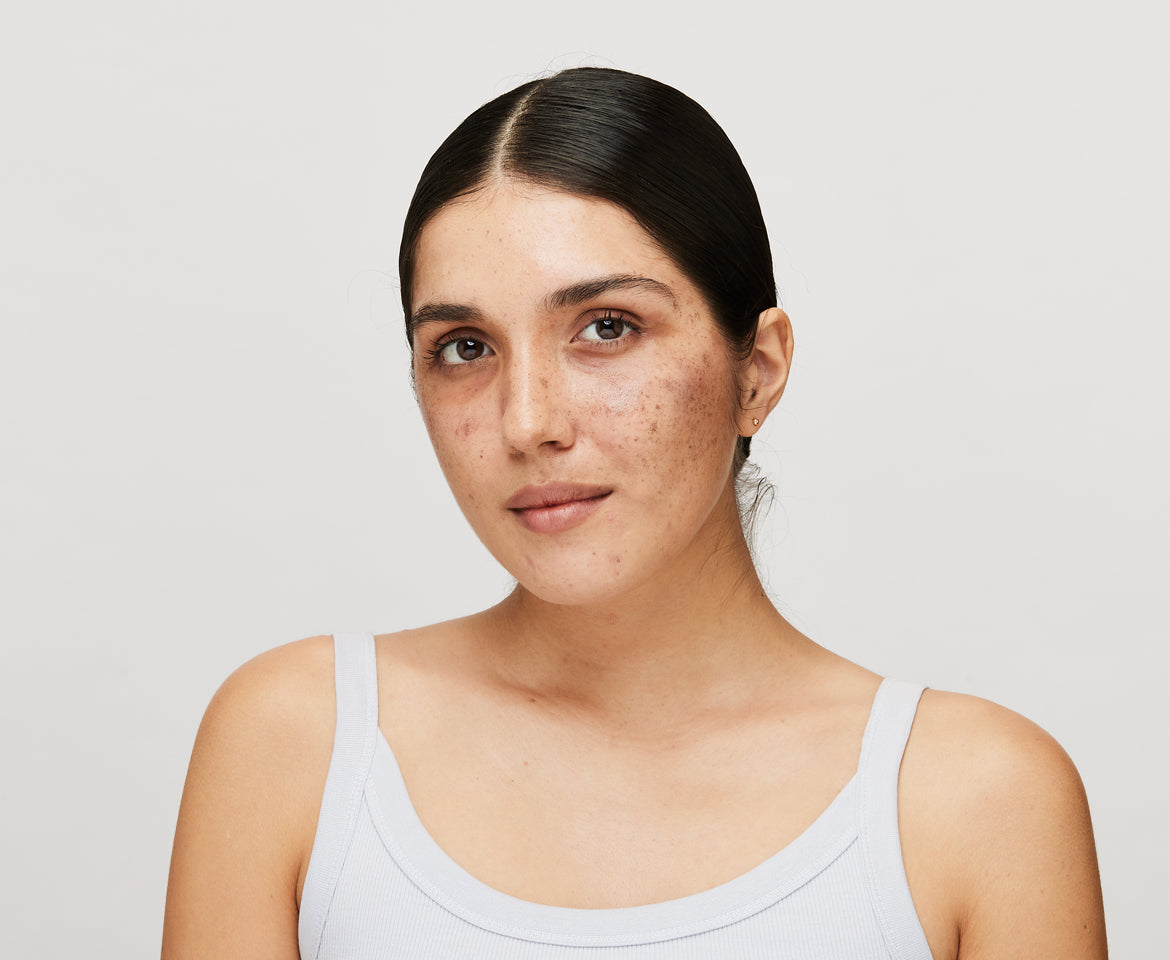 Skincare solution for Pigmented skin