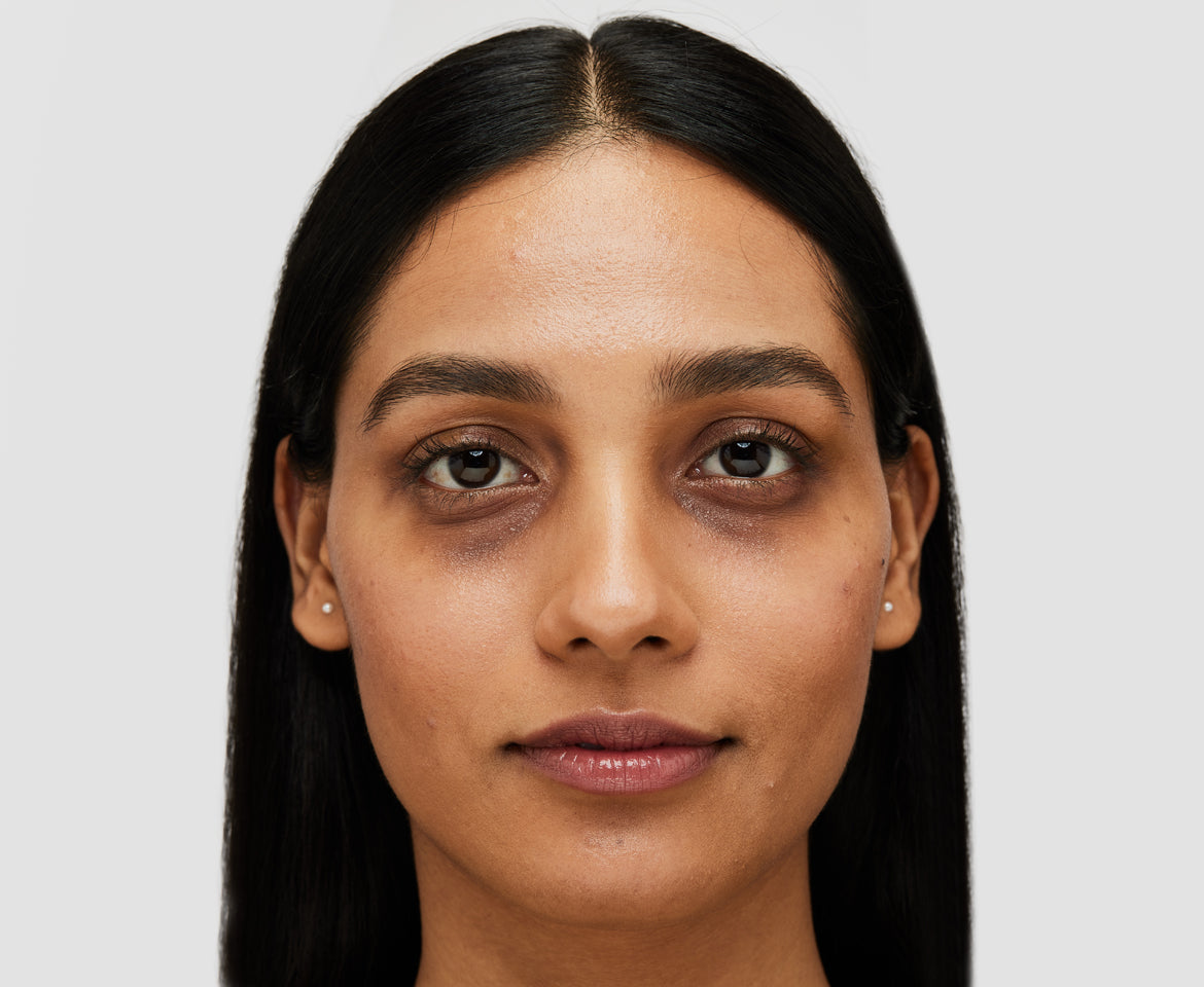 High Science technology to fight Dark Circles