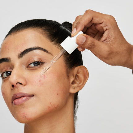 Advanced Skincare Technology for Genetic and Hormonal Acne#Switch to High Science for Genetic and Hormonal Acne