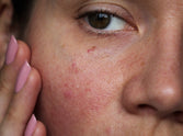 Protect sensitive skin with hypoallergenic skincare! Here’s how