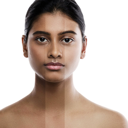 Melanin: Its Role and Impact on Skin Pigmentation