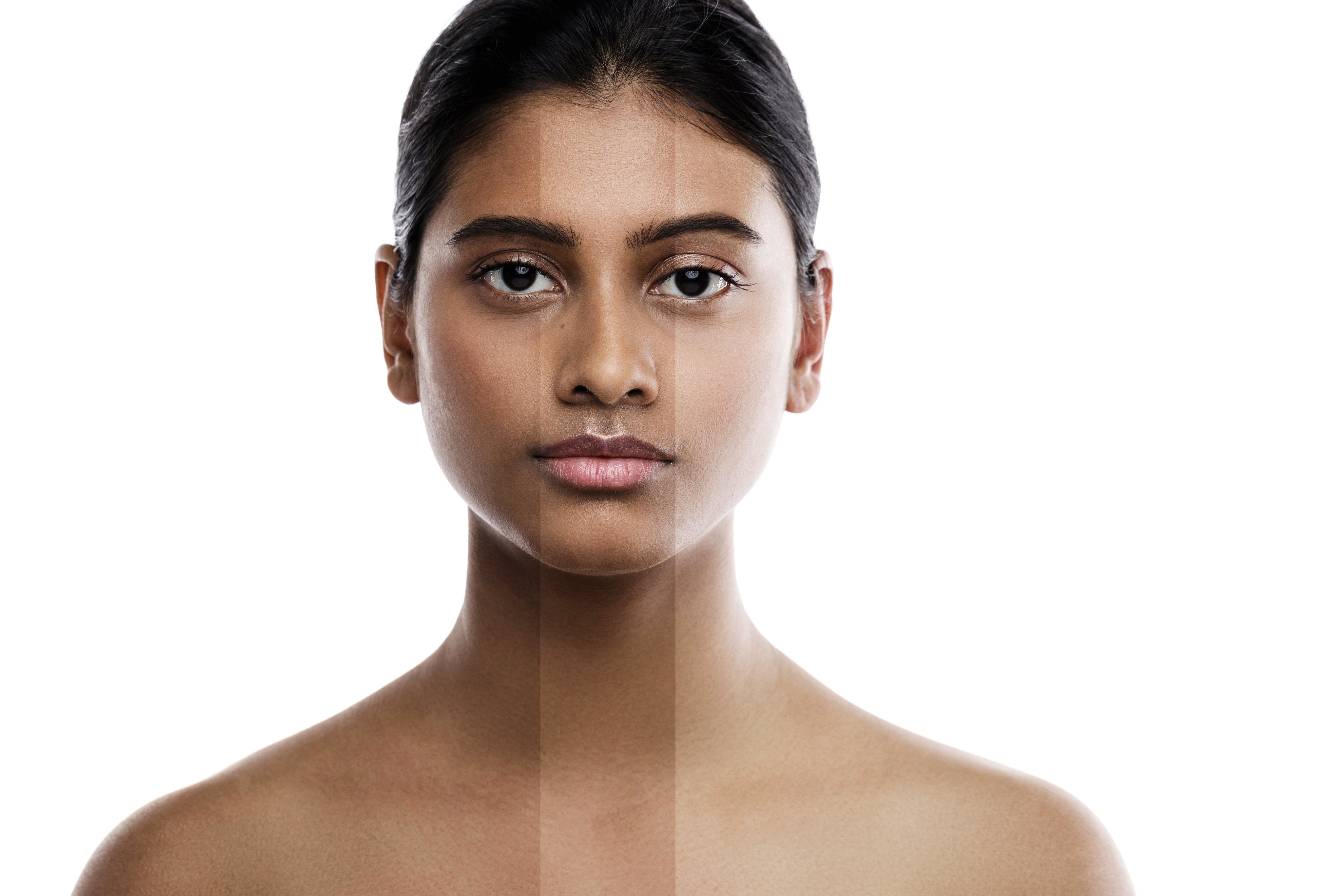 What is melanin and how it affects skin pigmentation
