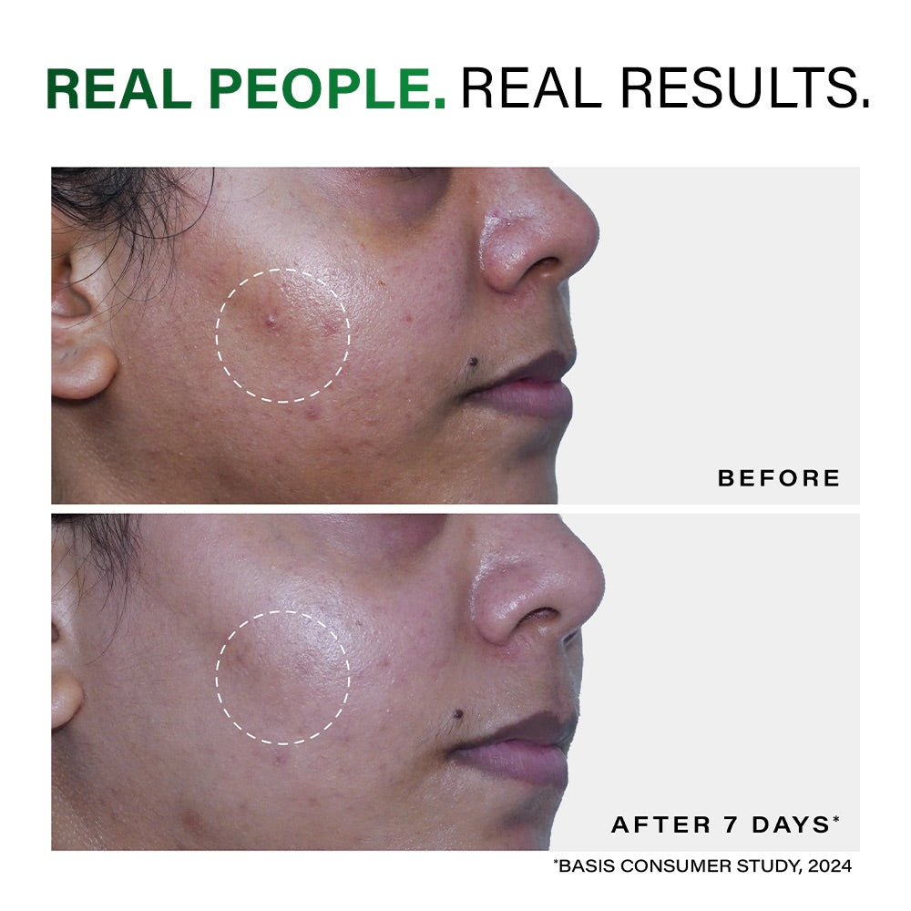 Acne Deep Clearing Cleanser