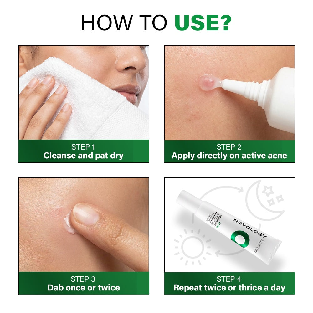 Acne Rescue Spot Corrector, 30g