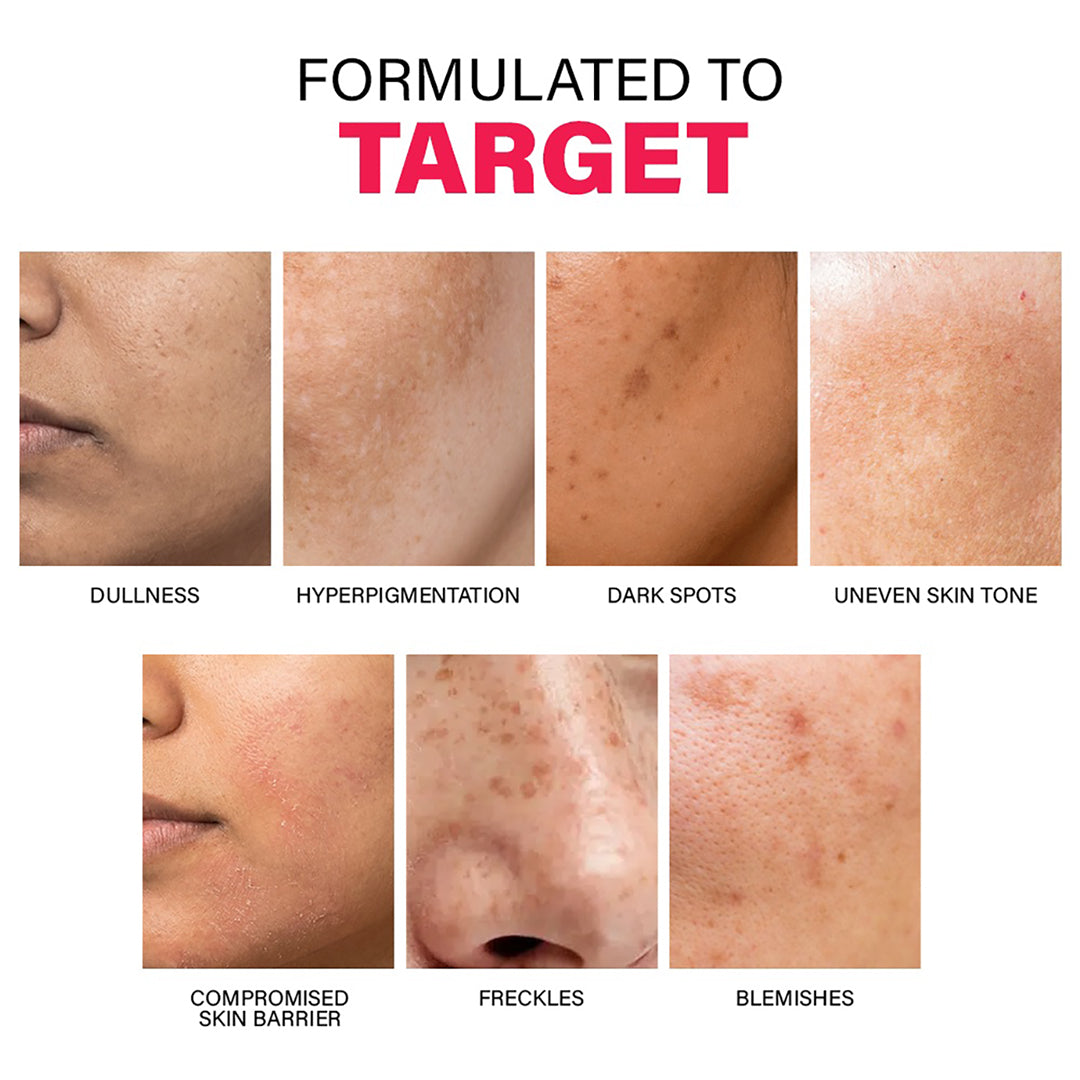 Pigmentation Reduction Moisturizer, 50g