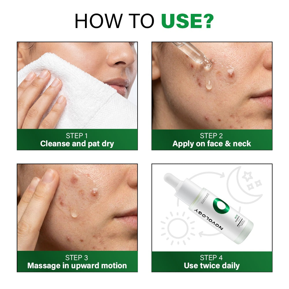 Acne Clearing Serum, 28ml
