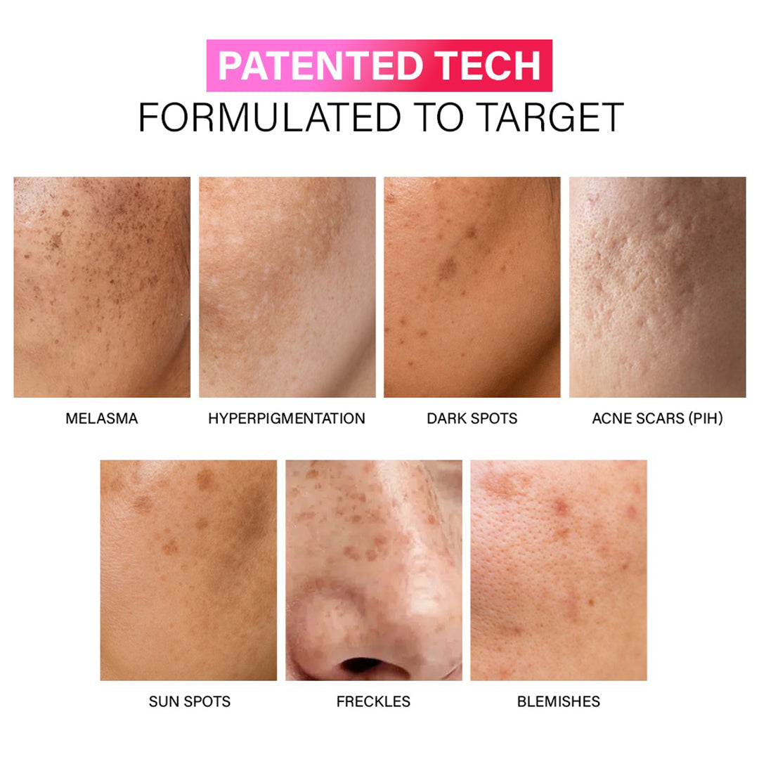 PIGMENTATION REDUCTION B1 PHASIC  SERUM 28ML