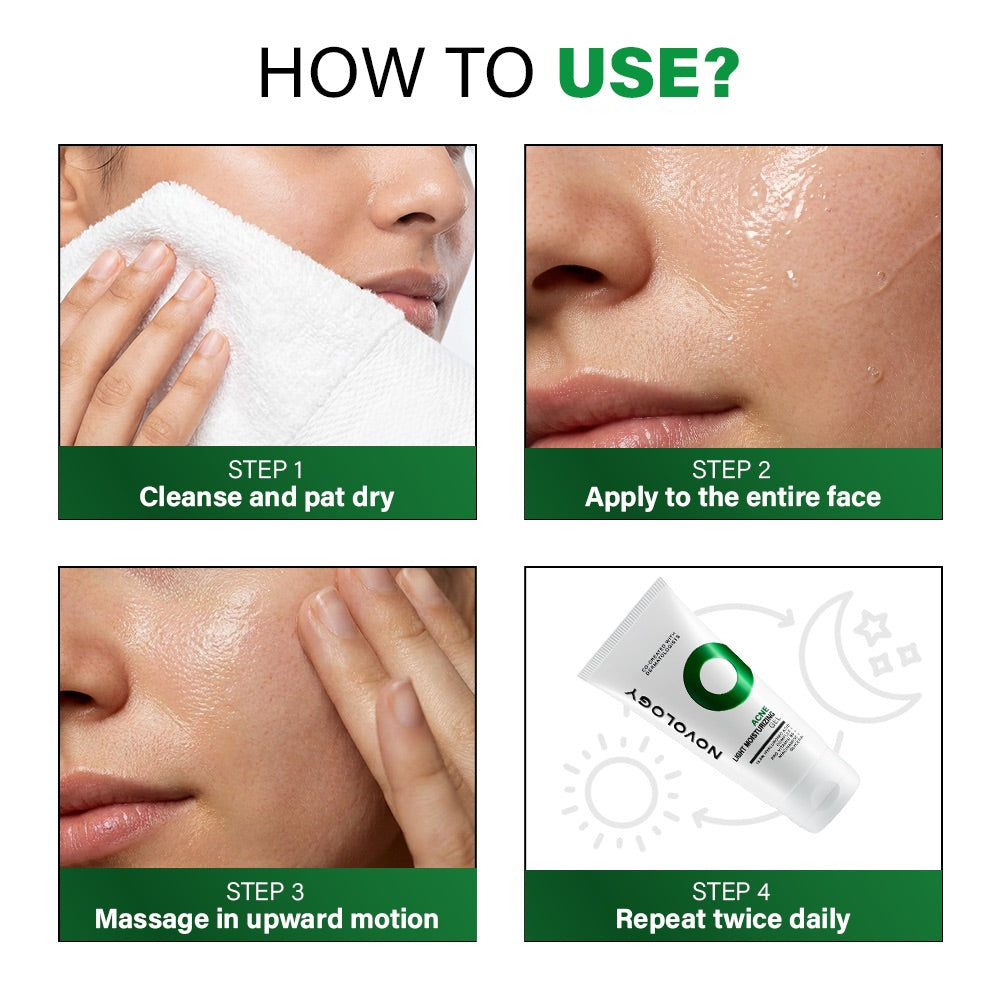 Acne Light Moisturizing Gel, 50g
