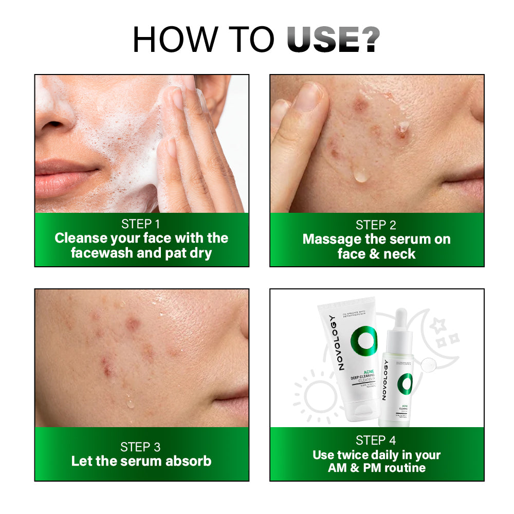 Acne Cleanser & Serum Duo | 100g + 28ml