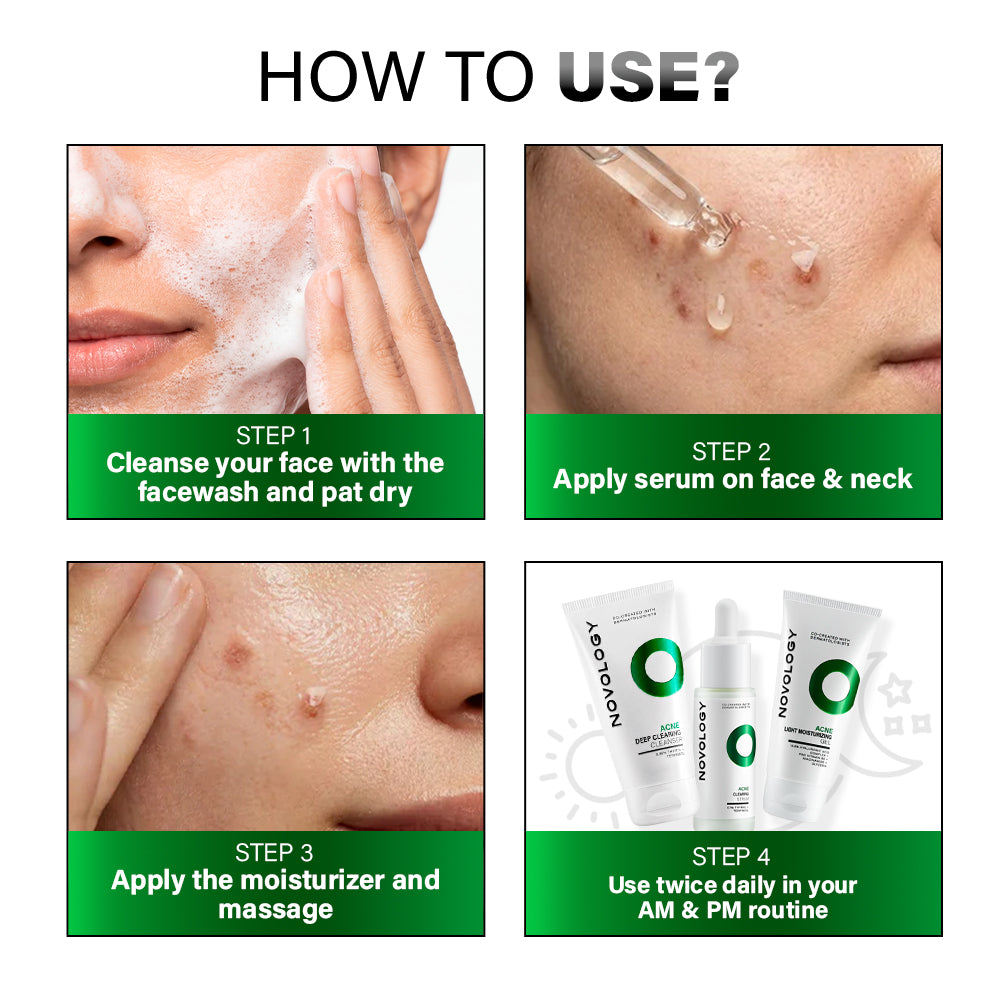 Acne Clearing Regime | 150g + 28ml + 50g