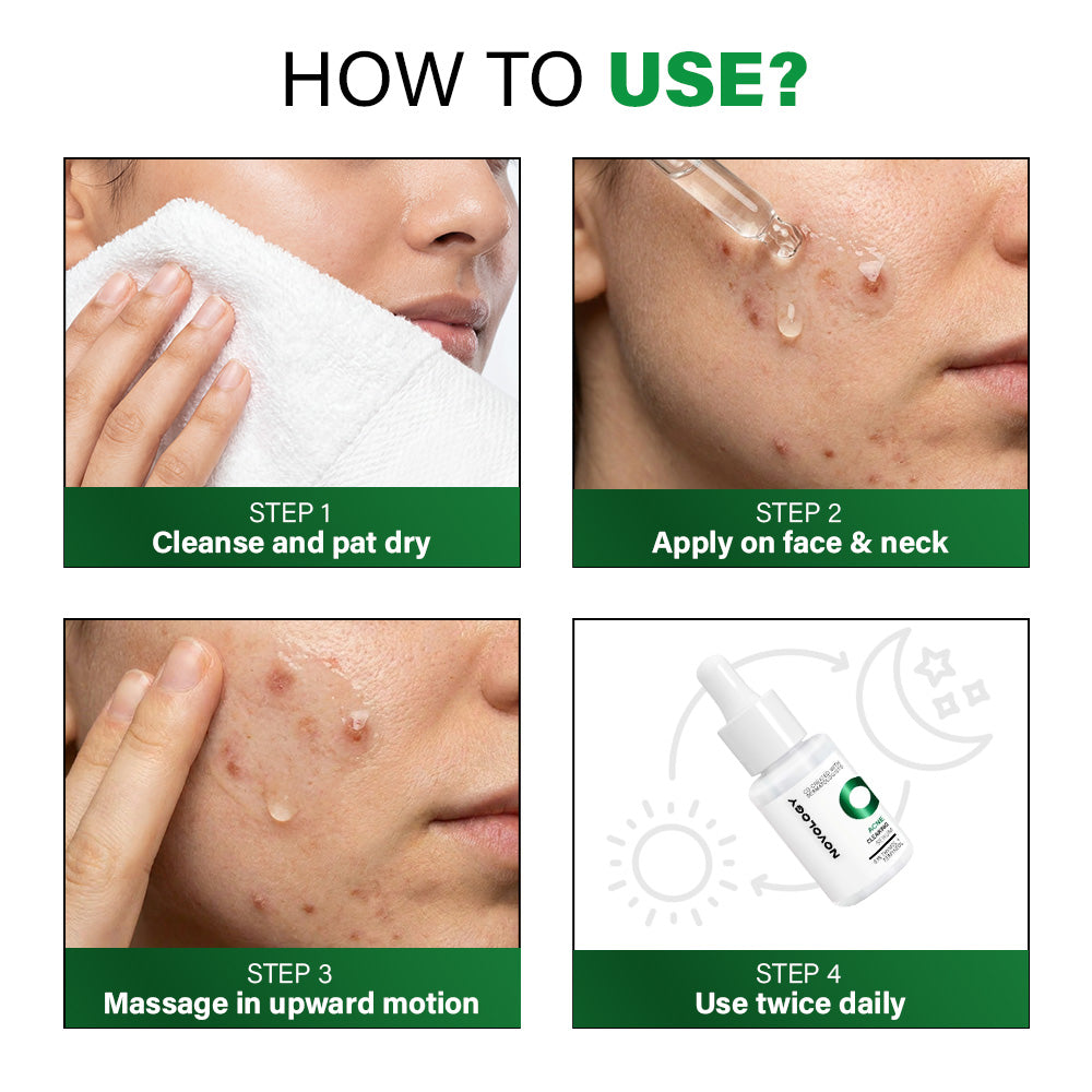 Acne Clearing Mini Serum, 10ml