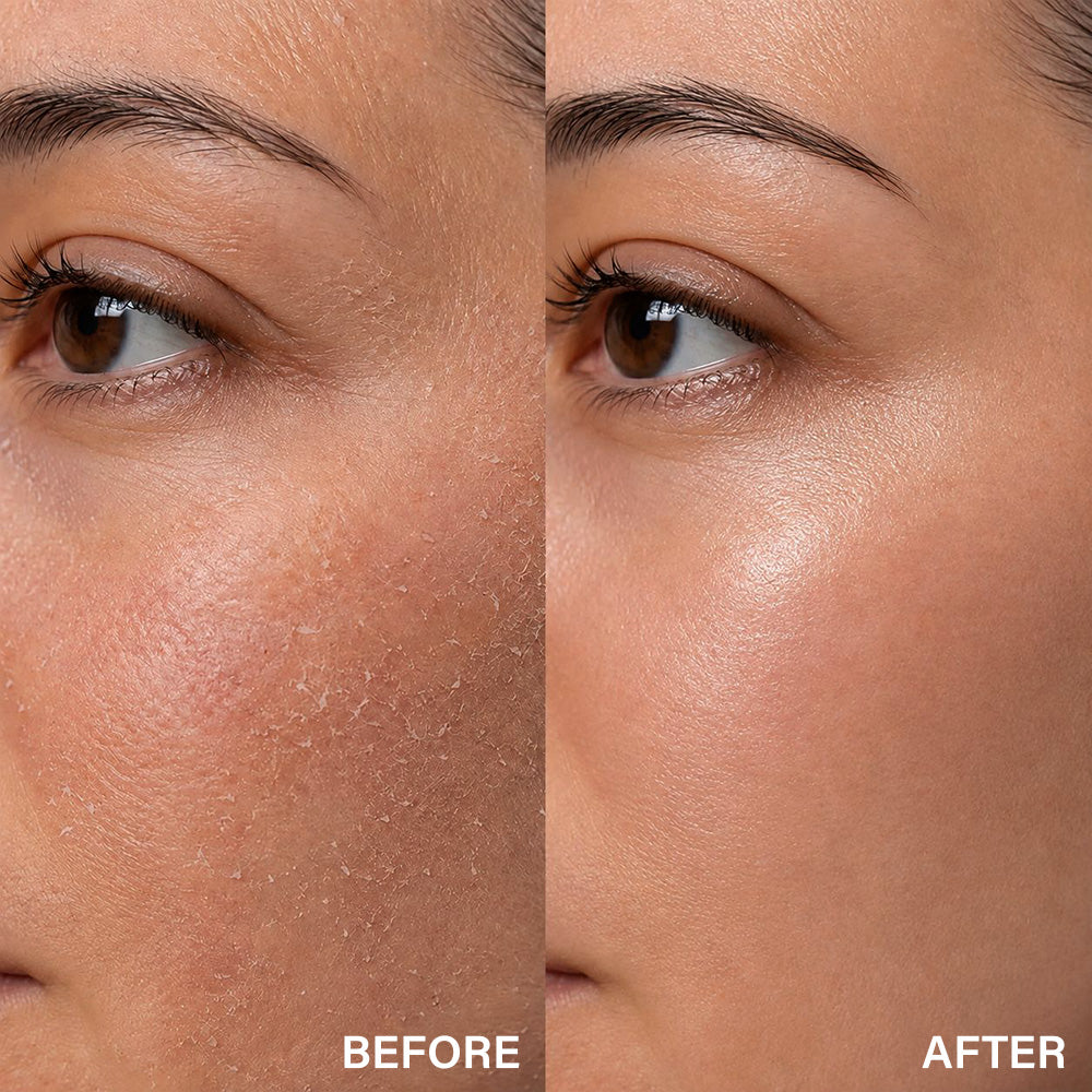 Moisture Barrier Boosting Hydrating Face Cream | 50g
