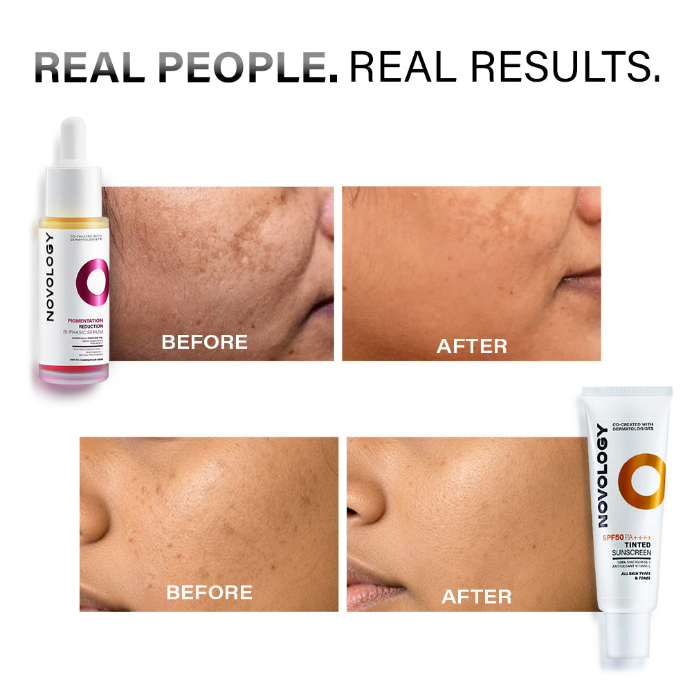 Pigmentation Serum & Sunscreen Duo | 28ml + 50g