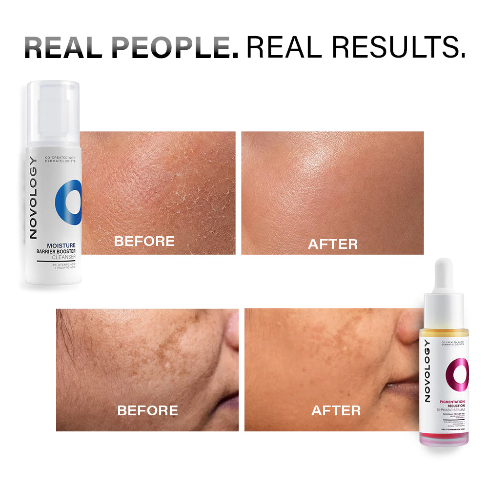 Dry Skin Cleanser & Pigmentation Serum Duo | 180g + 28ml