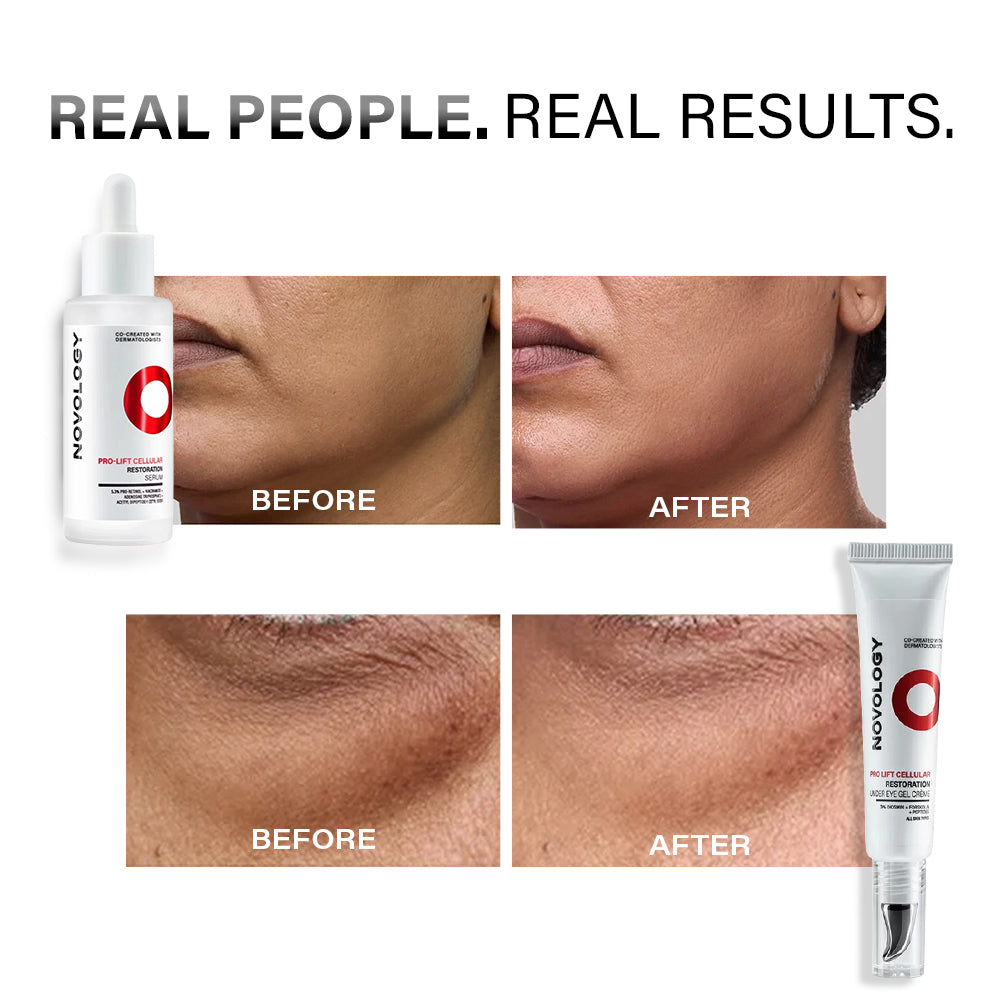 Pro-lift Cellular Restoration Anti-Ageing Duo | 28ml + 15g