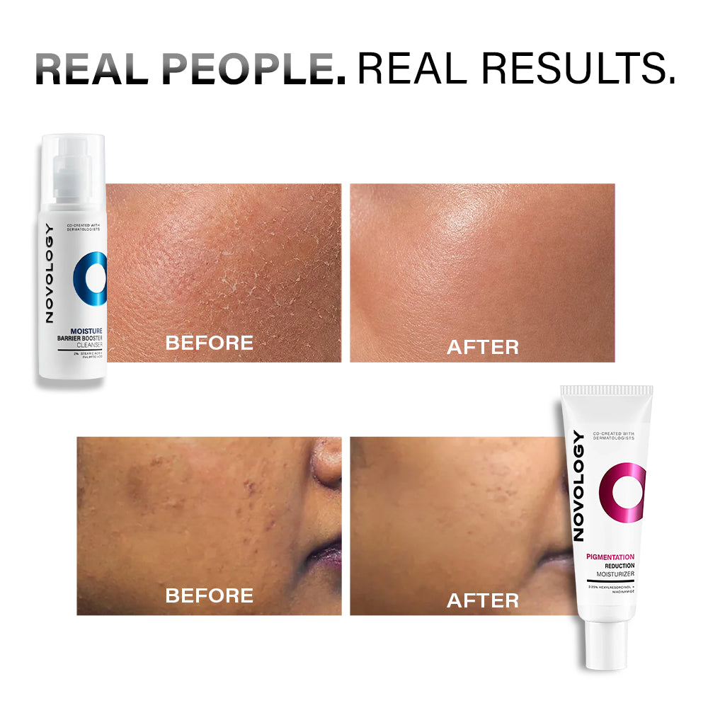 Dry Skin Cleanser & Pigmentation Moisturizer Duo | 180g + 50g