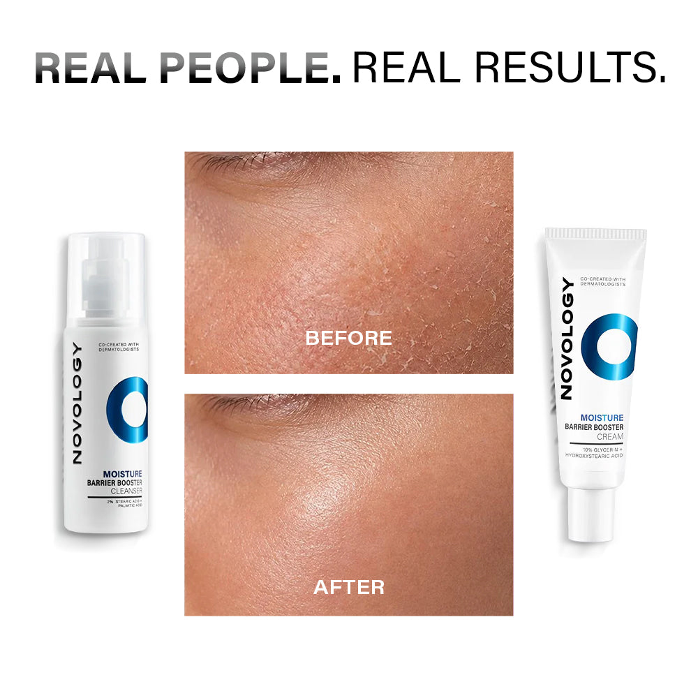 Sensitive Skin Regime, 180g + 50g