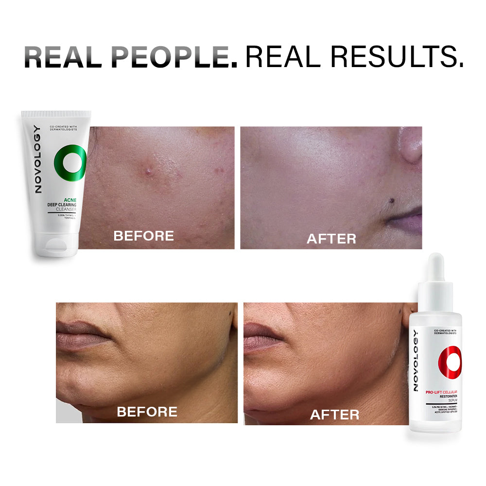 Acne Cleanser & Anti Ageing Serum Duo