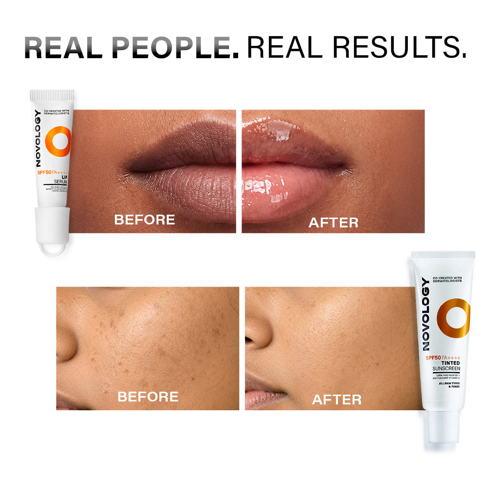 Face & Lip Pigmentation Reduction Duo | 50g + 10g