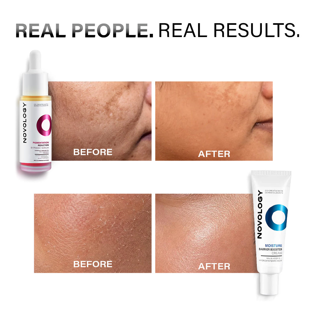Pigmentation Serum & Dry Skin Cream Duo | 28ml + 50g
