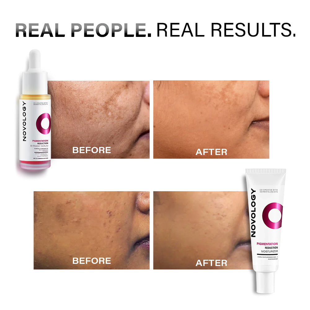 Pigmentation Reduction Duo