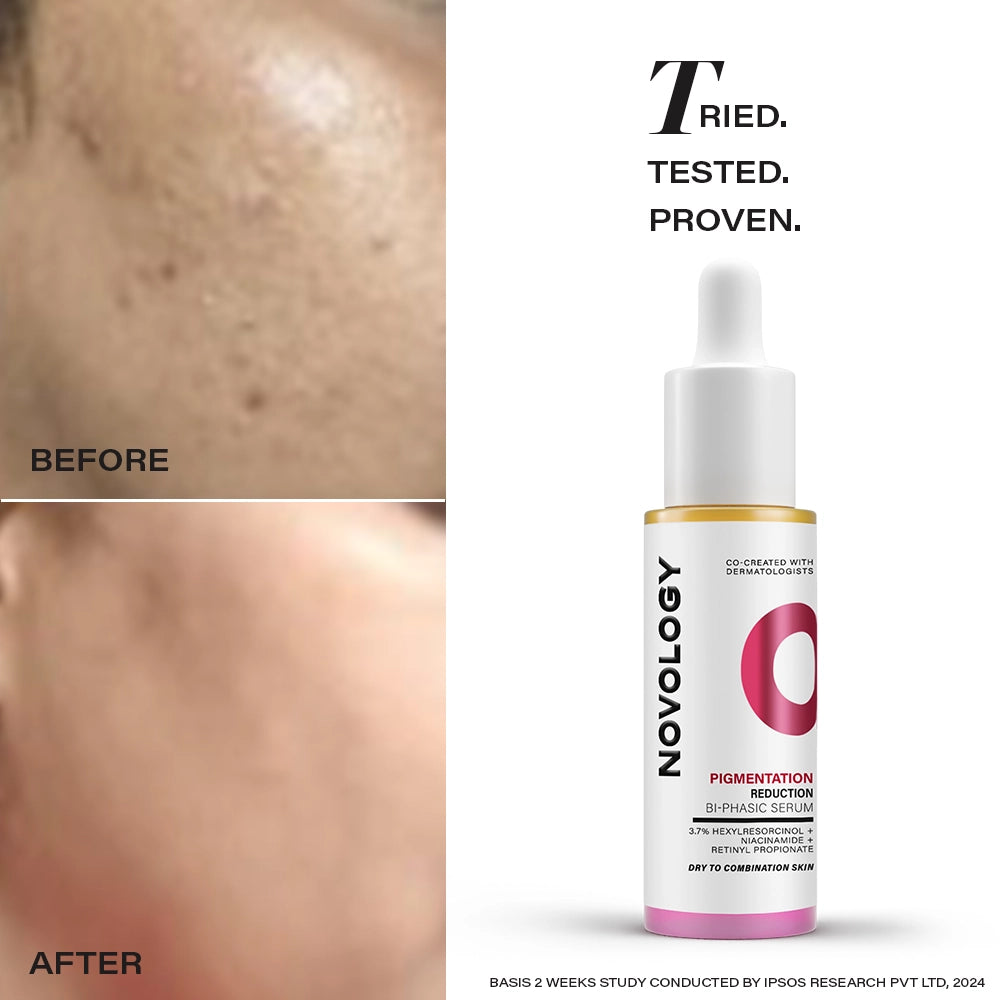Best Hyperpigmentation Face Serum with Niacinamide | Novology