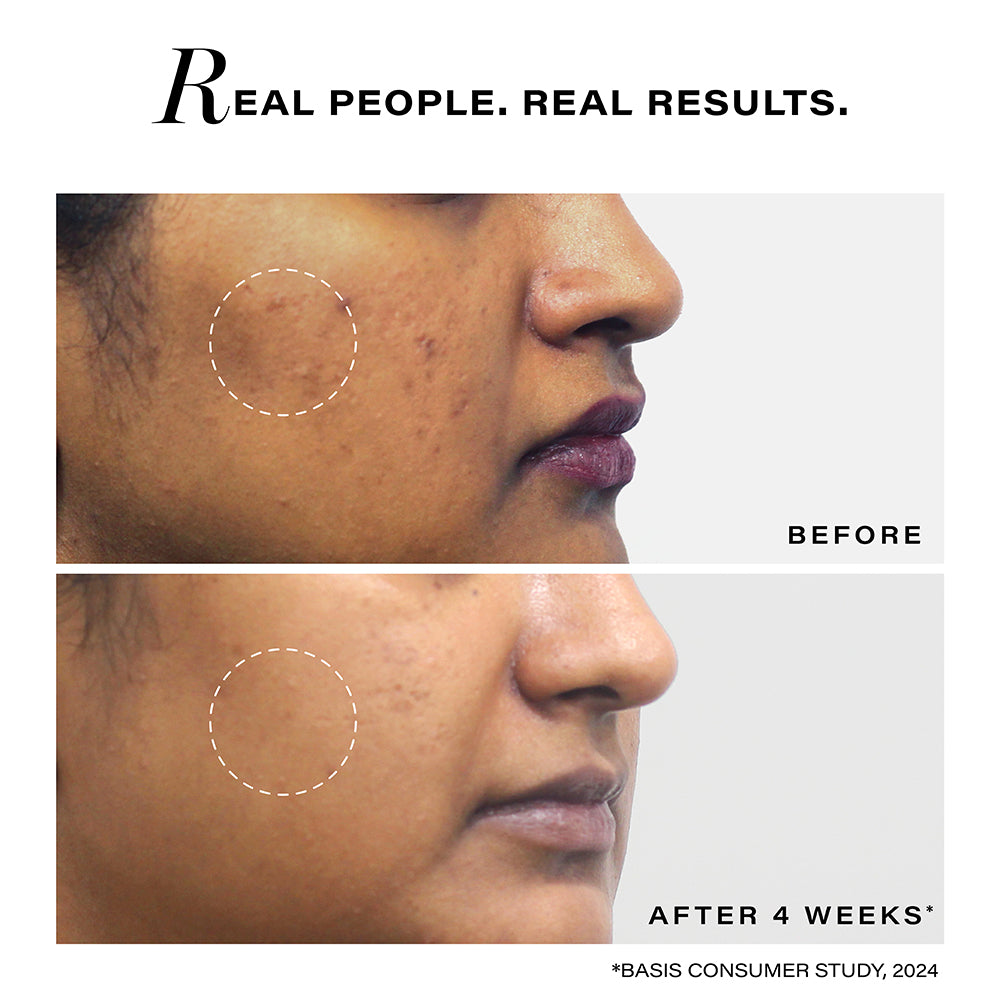 Pigmentation Reduction Moisturizer, 50g