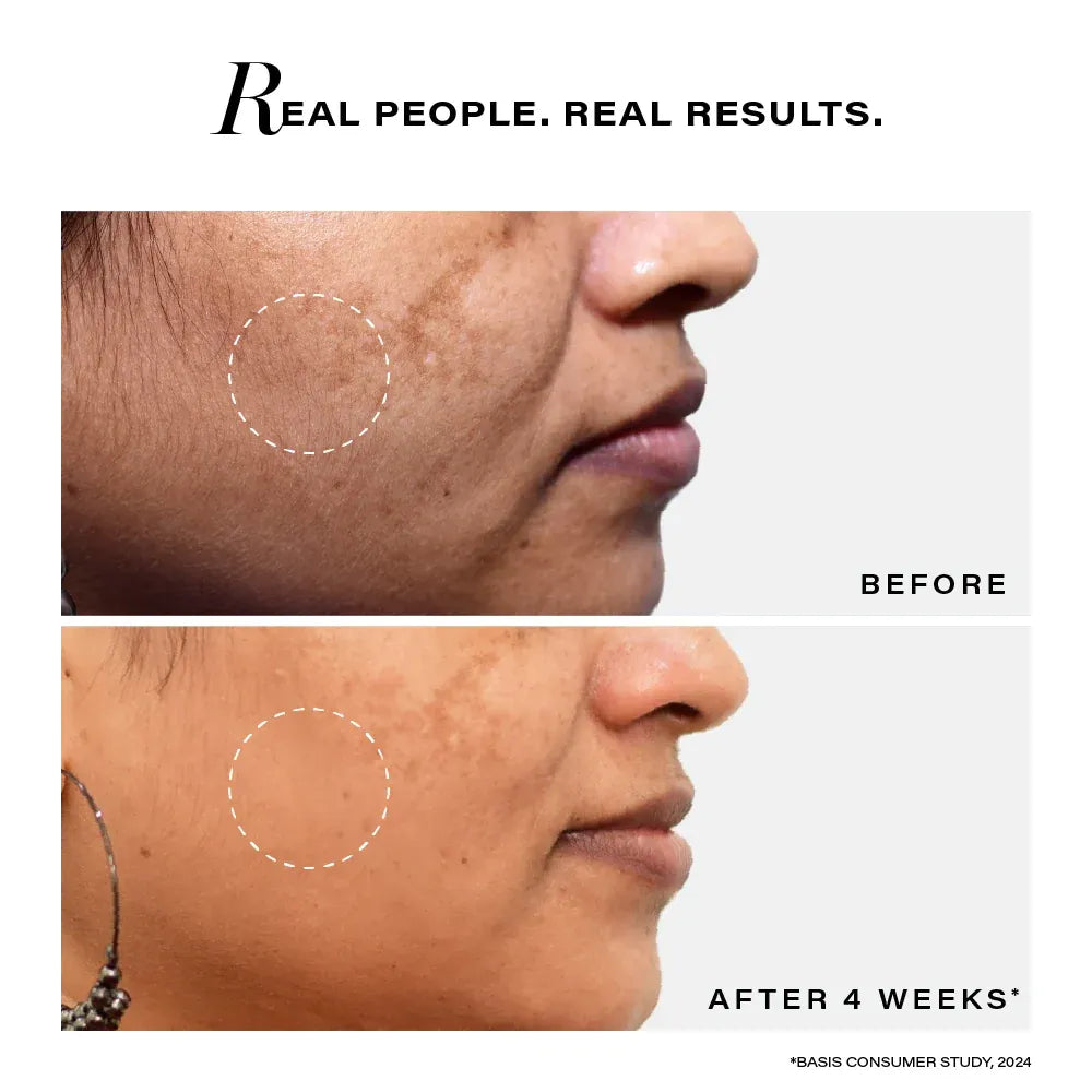 Pigmentation Reduction Bi-Phasic Serum, 28ml