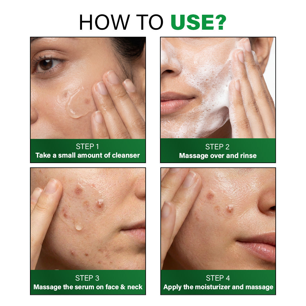 Acne Clearing & Hydrating Regime