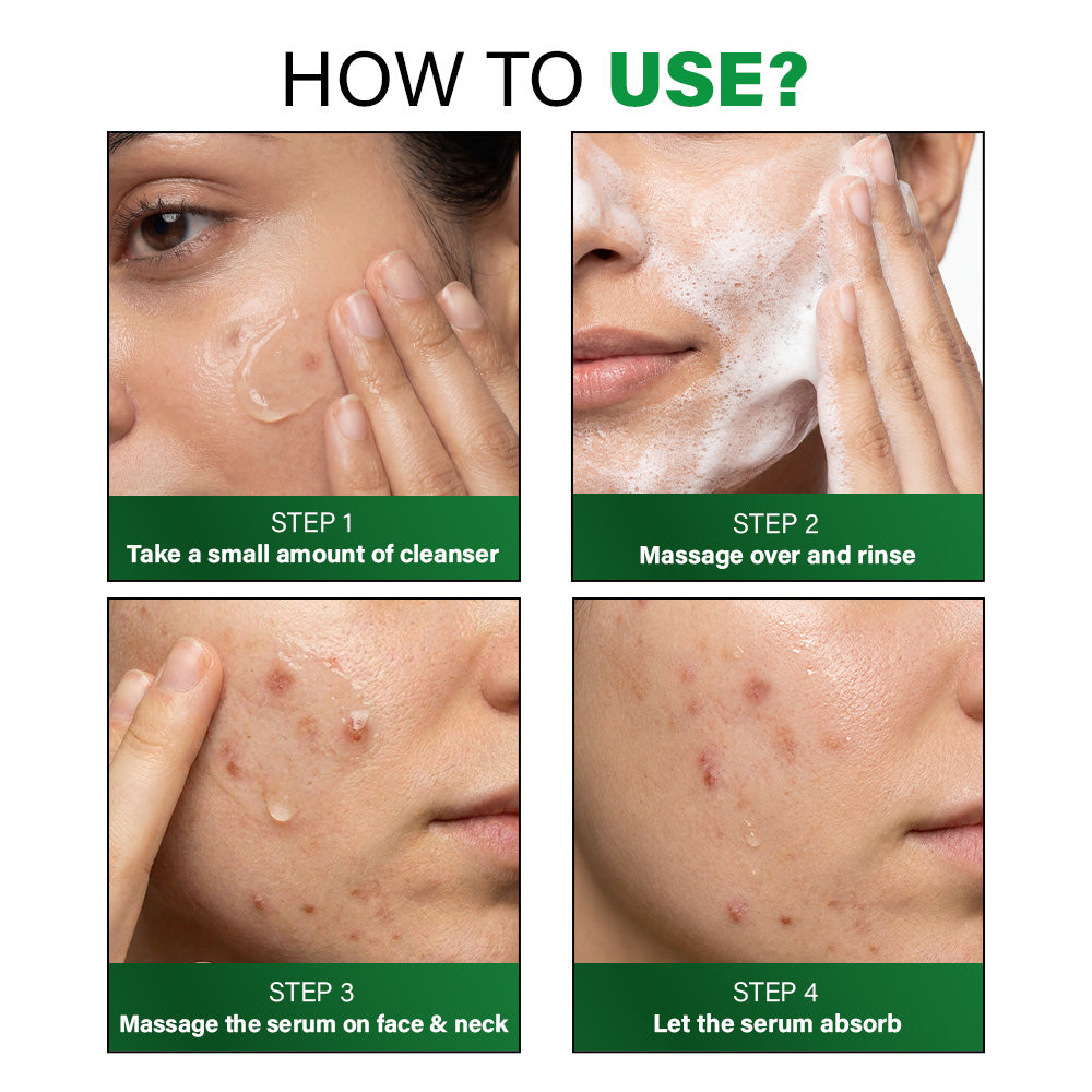 Acne Clearing Regime, 100g + 28ml