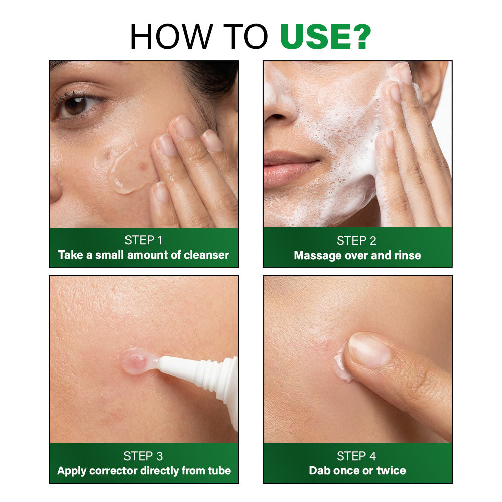 Acne Cleanser & Corrector Combo 150g + 30g