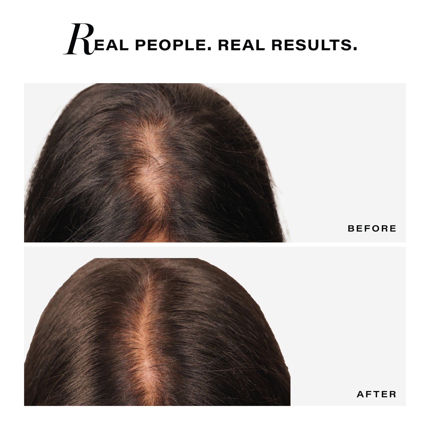 Follicle Revive Scalp Serum for Hair Growth, 50ml