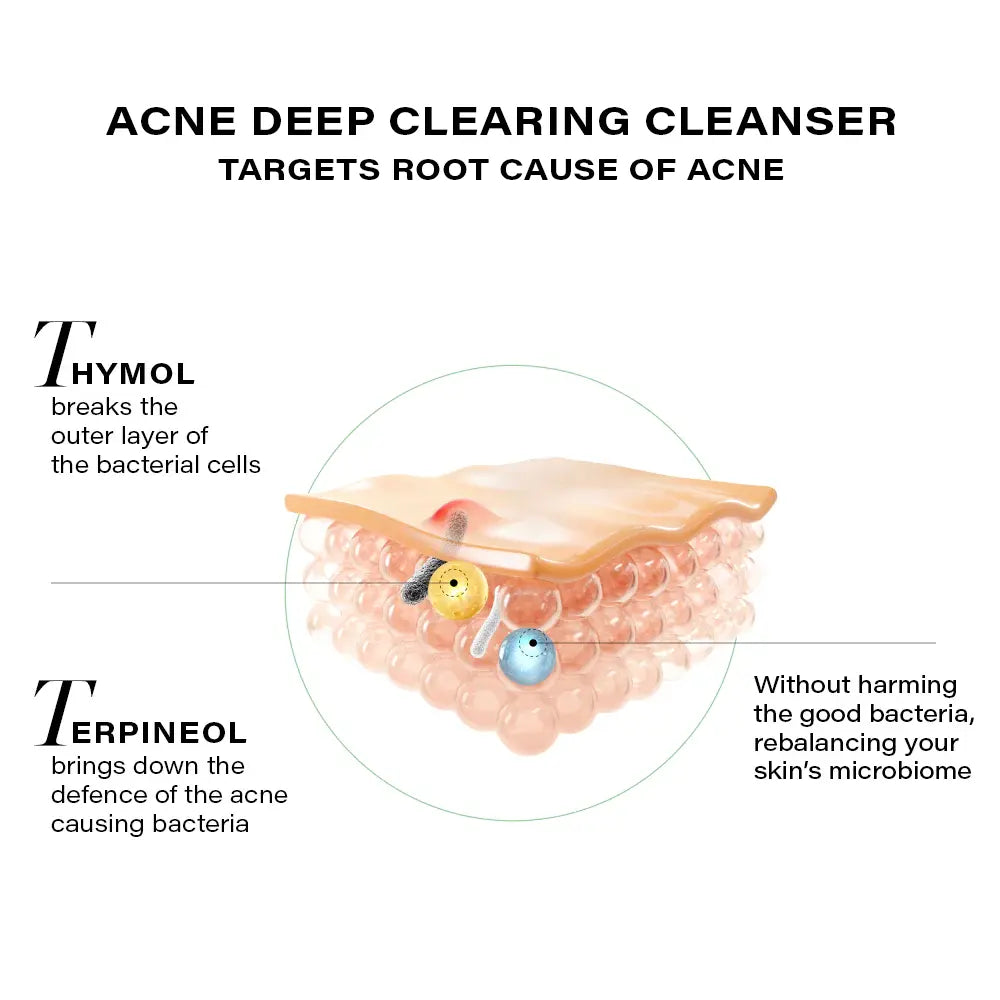 Acne & Pigmentation Reduction Duo, 150g + 28ml