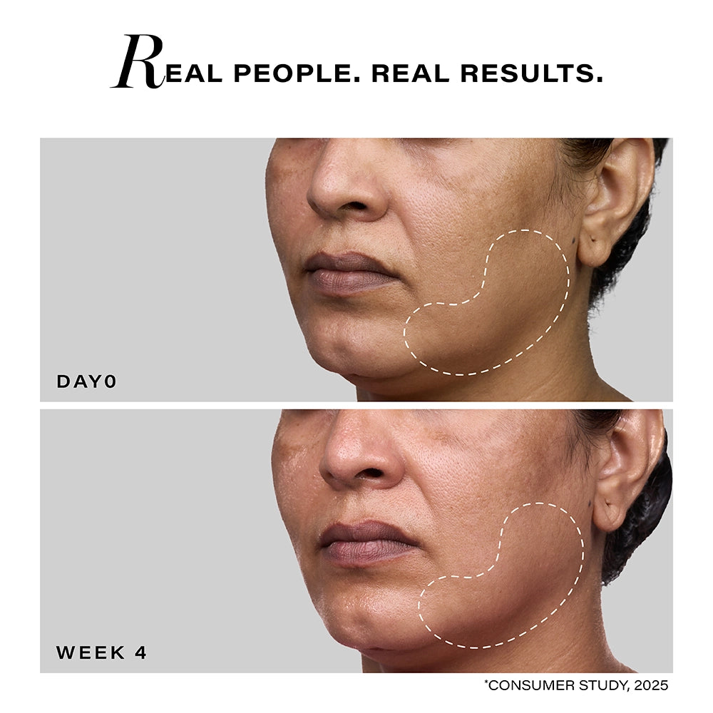 Pro-Lift Cellular Restoration Serum, 28ml