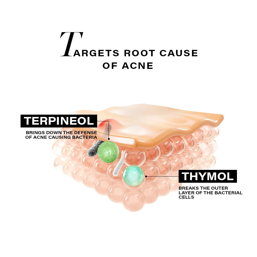 Acne Clearing & Hydrating Regime 100ml + 30ml + 50g